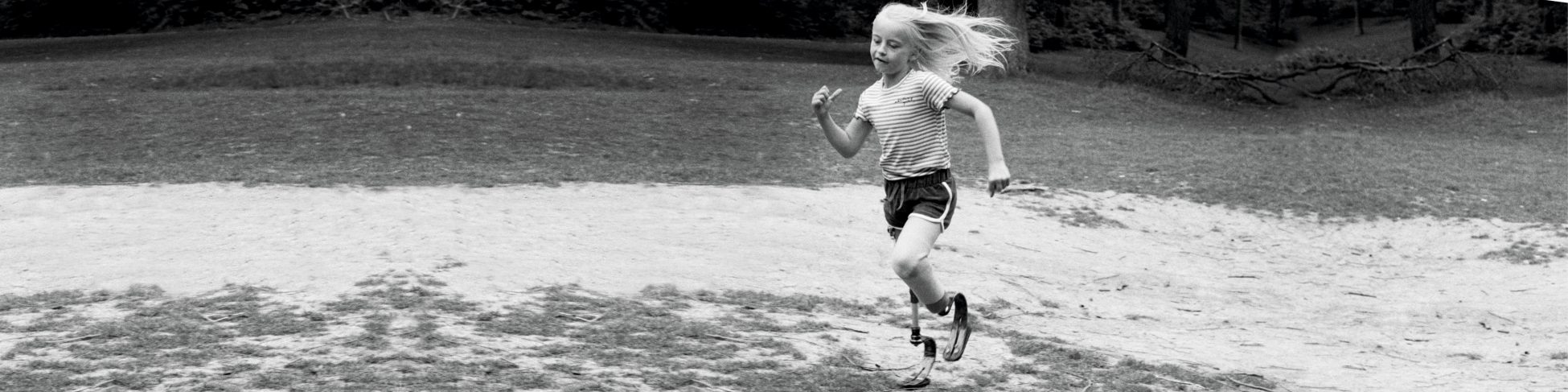 Kleines Mädchen mit einer Beinprothese läuft über einen Rasen. | VIACTIV Krankenkasse