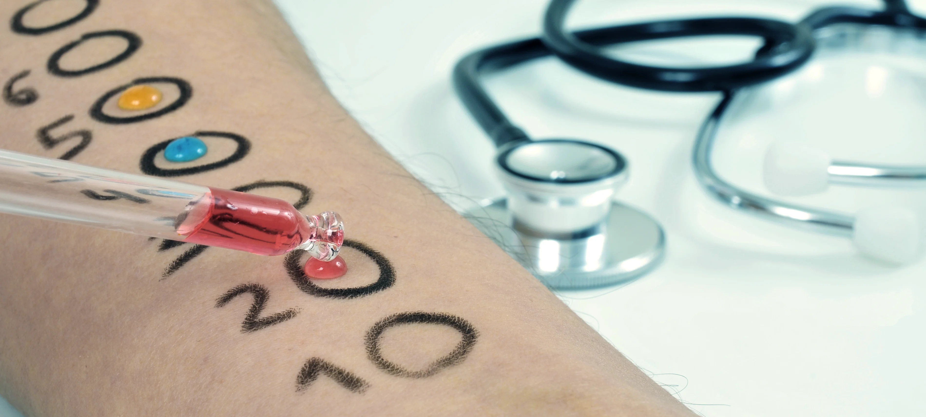 Ein Allergietest (Prick-Test) auf einem Unterarm. | VIACTIV Krankenkasse