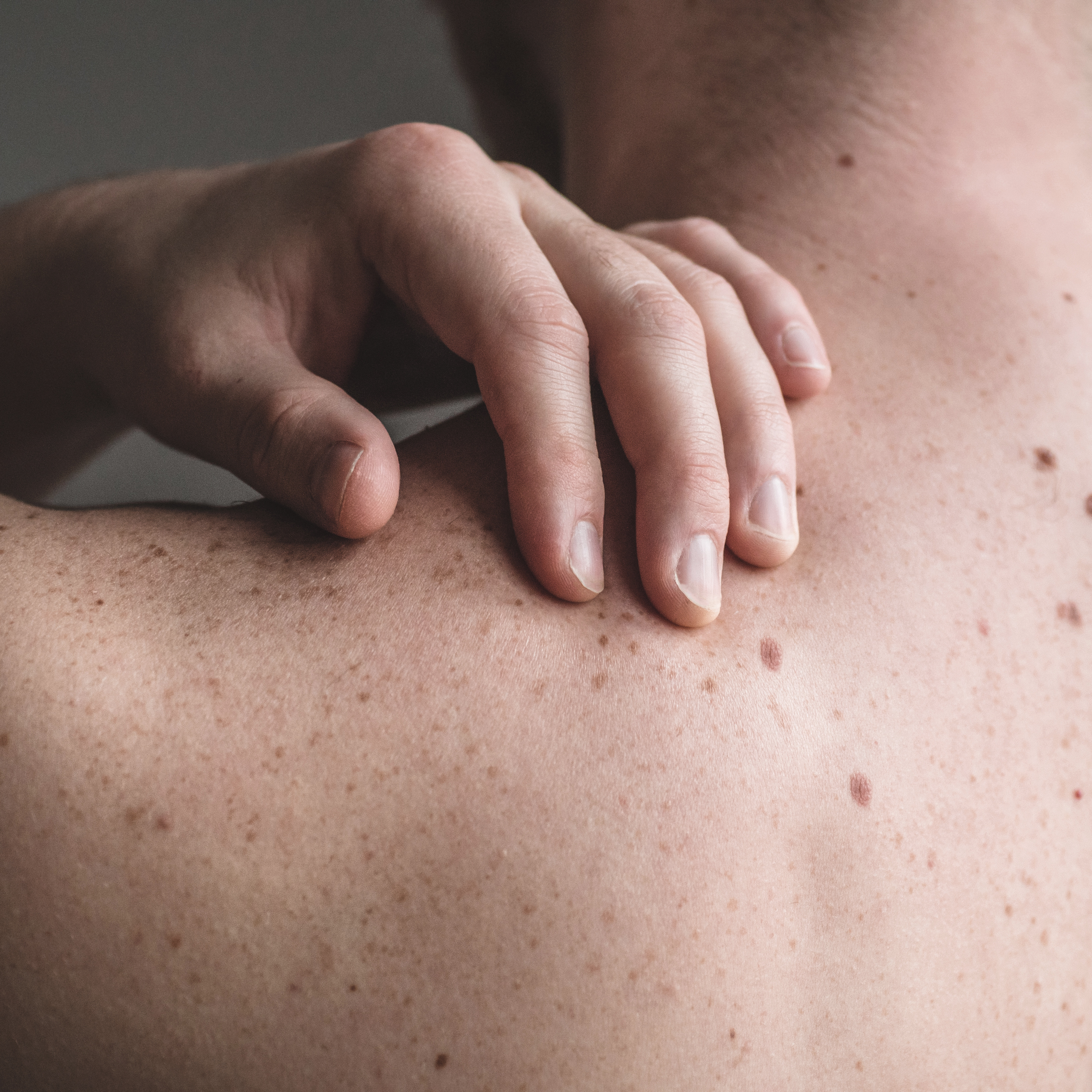 VIACTIV Krankenkasse