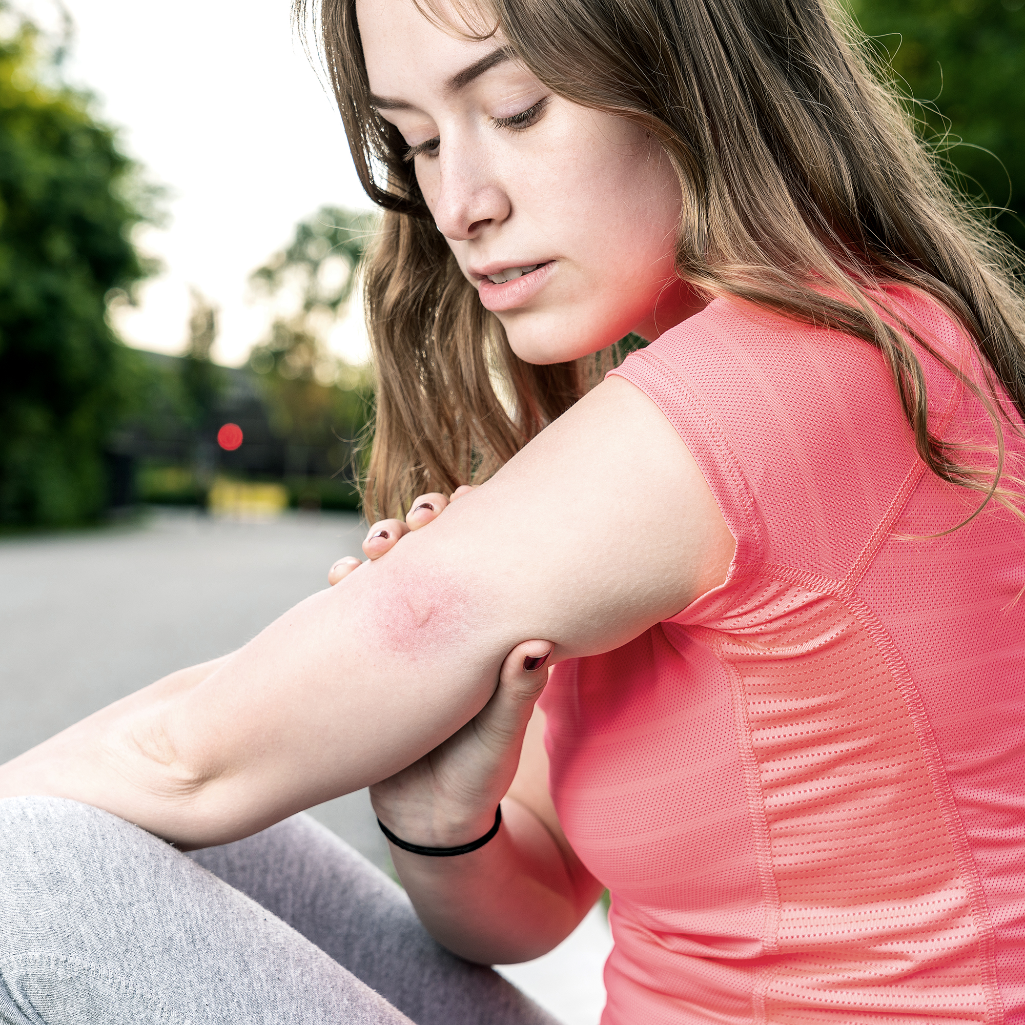 Viactiv Krankenkasse Insektenstich | VIACTIV Krankenkasse