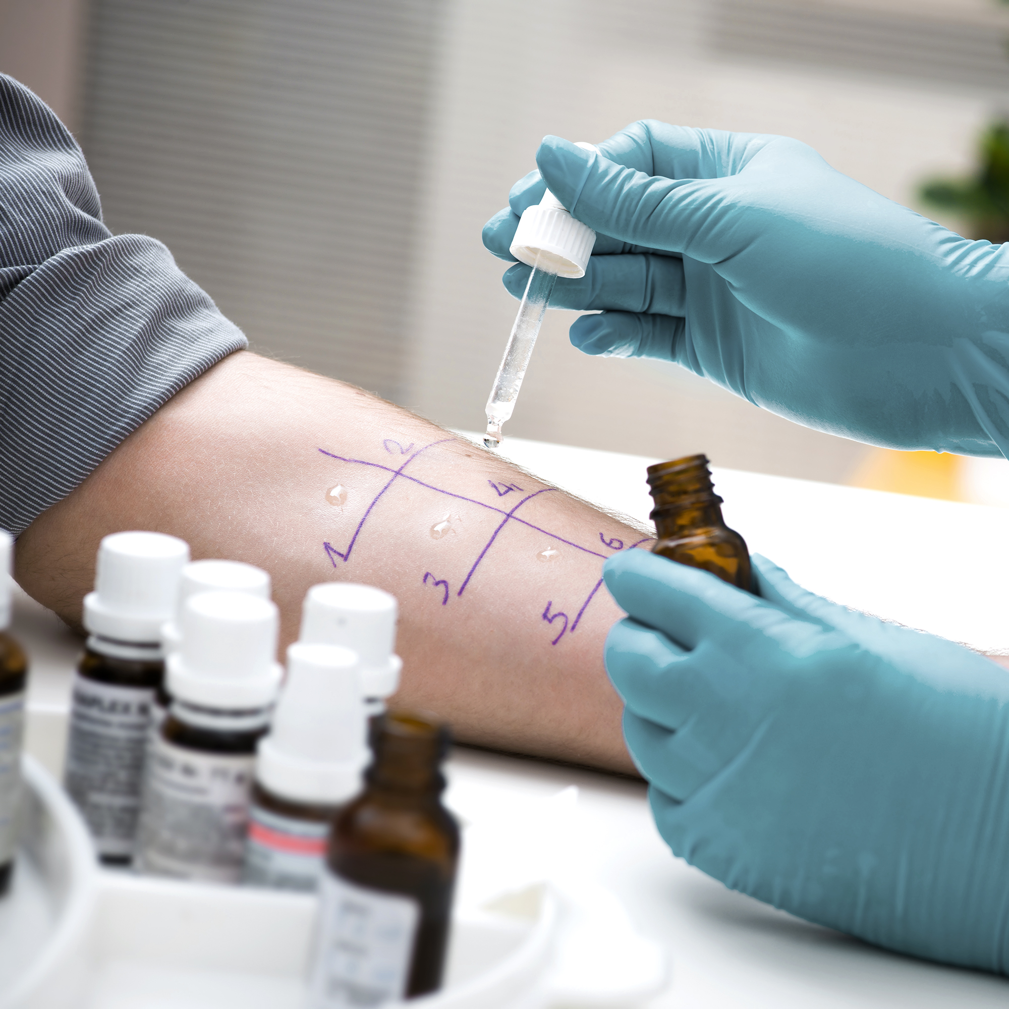 Viactiv-Krankenkasse-Medikamenten-Allergie | VIACTIV Krankenkasse